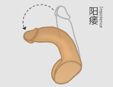 阳痿图片