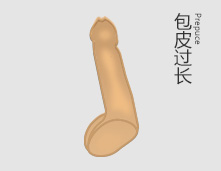 包皮过长图片